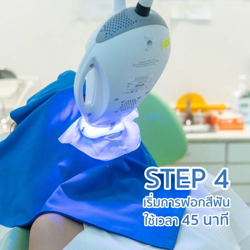 ฟอกฟันขาว ฟอกสีฟัน Zoom White Speed ที่ TDH Dental