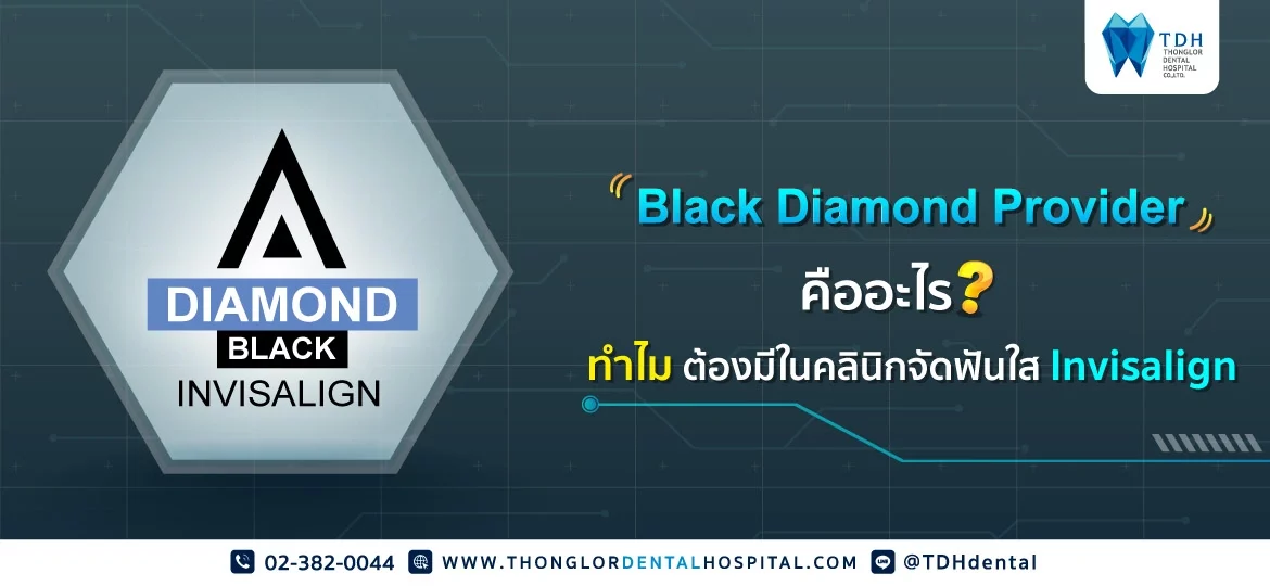 Black Diamond Provider คืออะไร