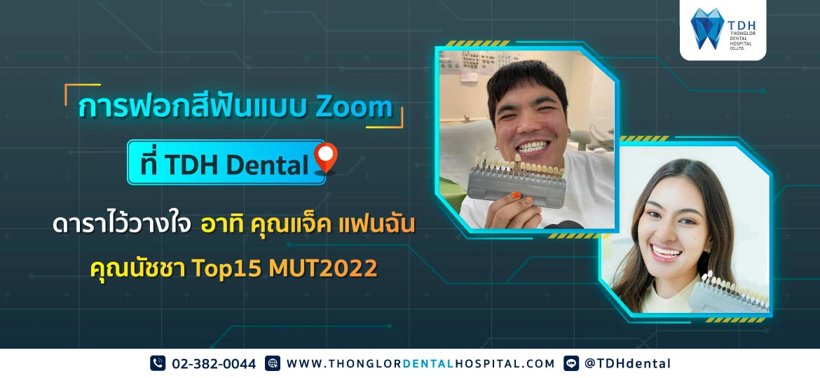 แจ็ค แฟนฉัน นัชชา MUT2022 ฟอกฟันขาว Zoom TDH Dental