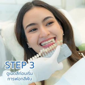 ฟอกฟันขาว ฟอกสีฟัน Zoom White Speed ที่ TDH Dental