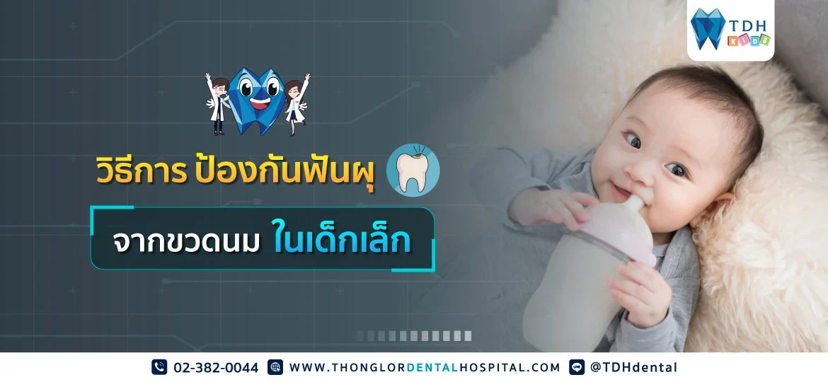 แก้ไขปัญหาลูกฟันผุจากขวดนม สำหรับพ่อแม่ที่ลูกติดขวดนม