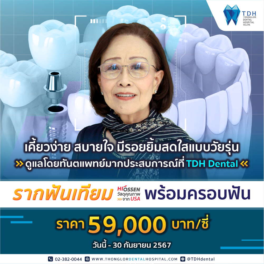 โปรโมชั่นทำฟัน รากฟันเทียม 2566 ราคาพิเศษ 55,000 บาท