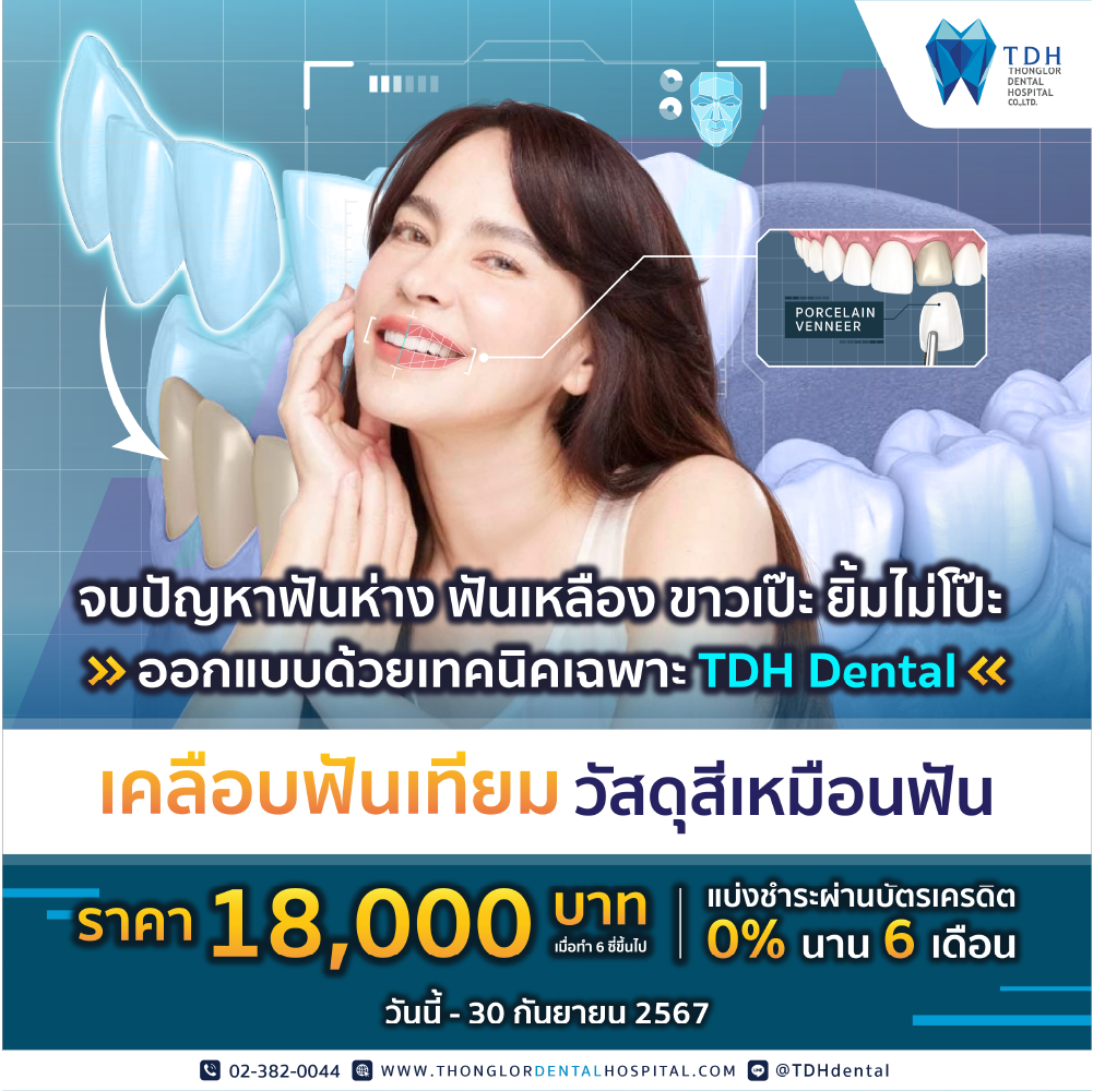 โปรโมชั่นวีเนียร์ veneer เคลือบฟันเทียม 2566 ราคา 18,000 บาท