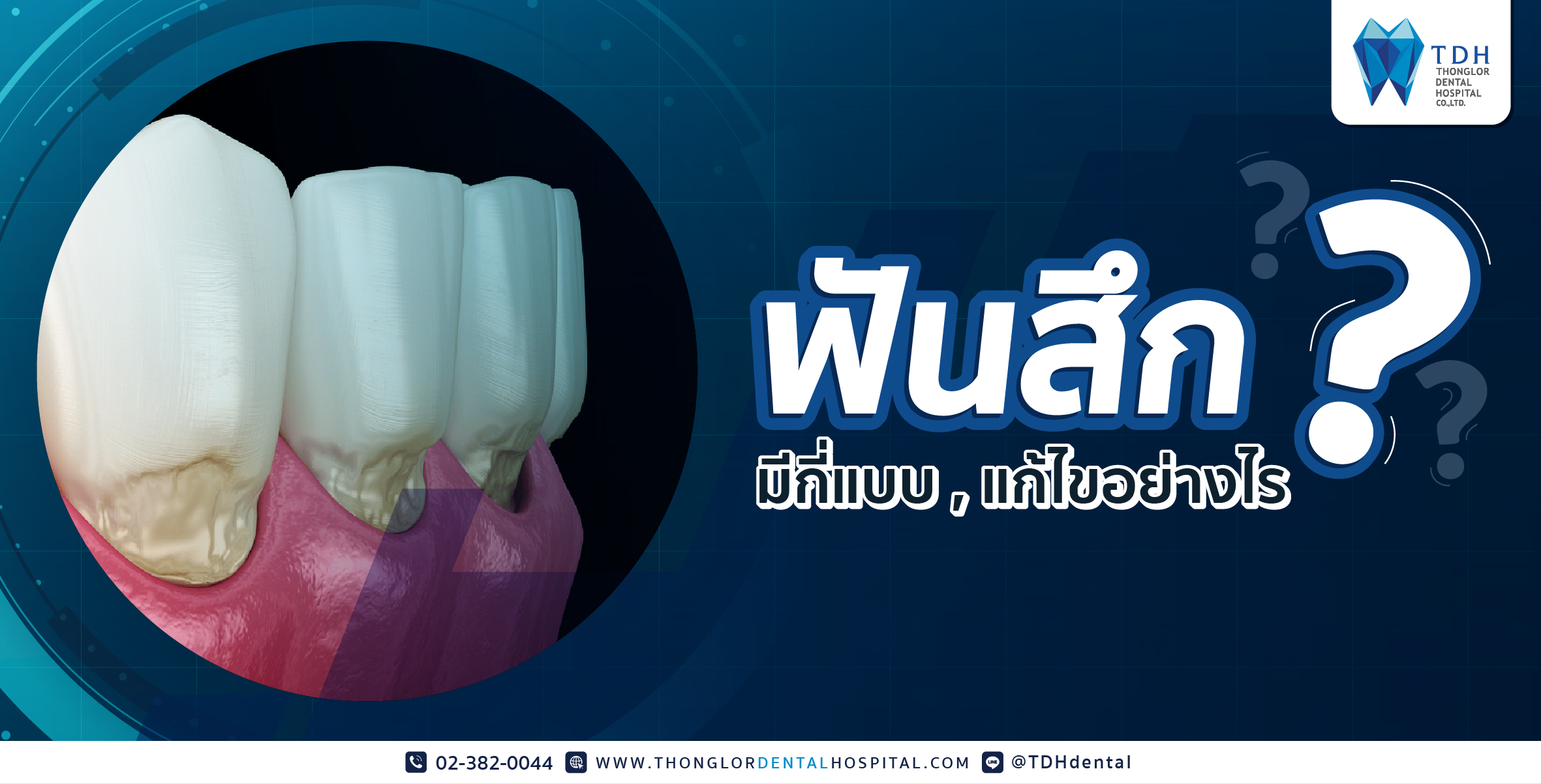 ฟันสึก มีกี่แบบ แก้ไขอย่างไร